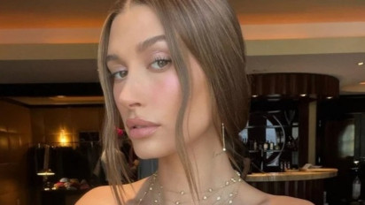 Disangka Hamil, Ternyata Hailey Beiber Idap Kista Ovarium