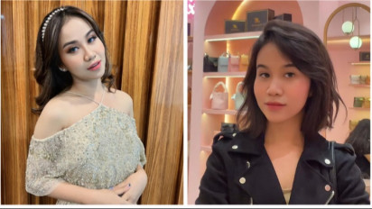 Wah! Tak Disangka Ternyata Ini Alasan Mayang Lucyana Lakukan Operasi Hidung di Akhir Tahun 2022!