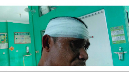 Wartawan di Pesawaran Lampung Dibacok OTK Saat Konfirmasi Pengolahan Tambang Emas Ilegal