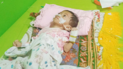 Bayi Penderita Gizi Buruk Sinjai Berjuang Hidup Ditengah Keterbatasan Ekonomi