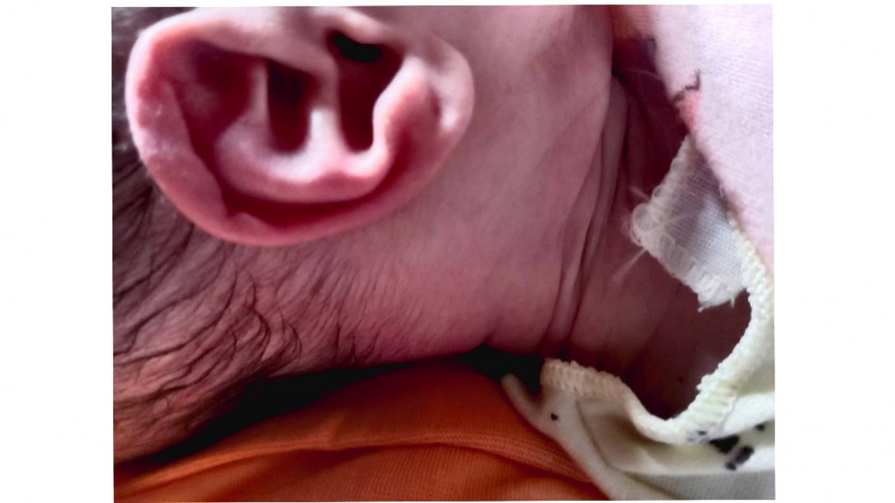 Viral! Telinga Bayi yang Baru Lahir Ini Bertuliskan Lafaz ALLAH
            - galeri foto