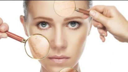 Punya Masalah Jerawat Bandel? Ketahui Tips Memilih Perawatan yang Tepat