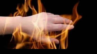 Pria Nekat Bakar Diri di Senen, Polisi : Alami Gangguan Kejiwaan