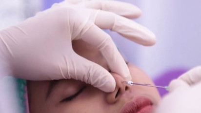 Botox dan Filler jadi Tren Skincare Tahun Ini