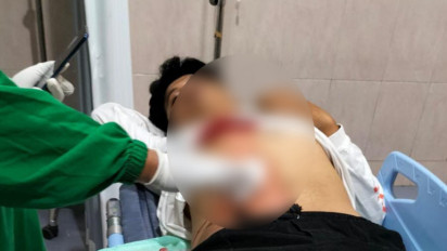 Gara-gara Rebutan Wanita, 2 Pria di Banyuwangi Duel hingga Perut Tertusuk Pisau