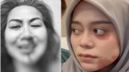 Senasib dengan Venna Melinda yang Kena KDRT, 5 Artis Indonesia ini Bonyok Disiksa Suami, Ditendang hingga Dibanting