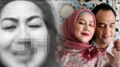 Update Kasus KDRT Venna Melinda, Hasil Visum, dan Ternyata Sering Alami Kekerasan Fisik dari Ferry Irawan