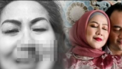 Sudah ‘Gelap Mata’ Hajar Venna Melinda, Kini Ferry Irawan Mengemis Minta Dimaafkan, Begini Kata Hotman Paris…