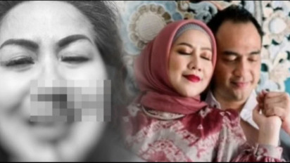 Nyesek, Hidung Venna Melinda Berdarah Akibat KDRT Ferry Irawan, Ternyata Keluarga Ferry Belum Minta Maaf Sama Sekali