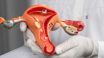Terobosan Terbaru, Kini Pemeriksaan Kanker Serviks Lebih Mudah Dengan CerviScan HPV-hr qPCR Diagnostic Kit dari Bio Farma