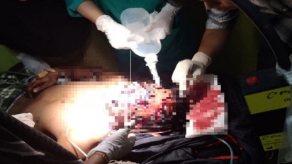 4 Warga Aceh Selatan Diterkam Harimau, Begini Kondisinya saat Ini