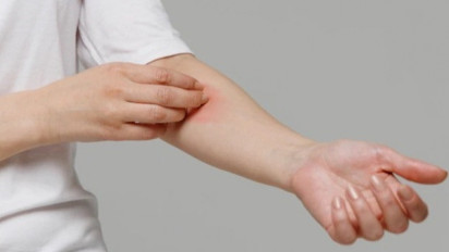 Waspada! Kelembaban Picu Alergi