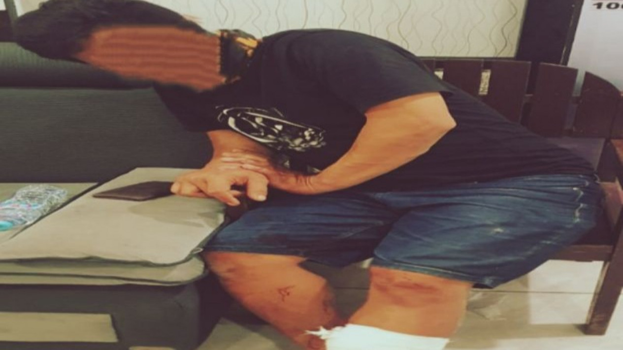 Seorang Pria Bakar Mantan Kekasihnya di Depan Sebuah Hotel Berbintang di Banjarmasin
            - galeri foto