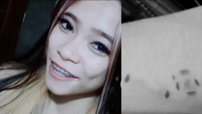 Ini Foto Bukti Cakaran dan Lebam di Tubuh Ibu Muda Jambi, Ada Bukti Sperma Bocah Juga, Yunita Sari Diperkosa 2 Keponakan Suami