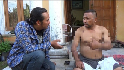 Polisi Buru Pelaku Penyiraman Air Keras Terhadap Seorang Warga saat Bentrok Dua Kelompok Remaja Pecah di Ciputat