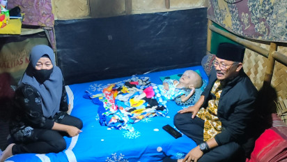 Derita Hidrosefalus, Mukhammad Ziban Bocah di Indramayu Butuh Bantuan Berobat