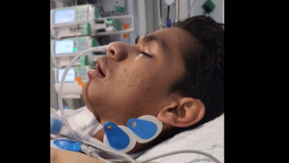 Kondisi Terkini David Korban Penganiayaan Mario Dandy: Didengarkan Selawat Allahul Kafi, Masih di ICU, dan Belum Sadar