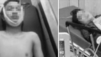 Seorang Pria Tewas di Key Garden Diduga Overdosis, Polisi Masih Lakukan Pemeriksaan