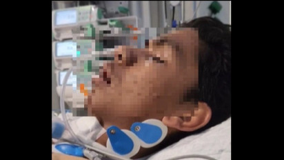 David Ozora Masih Terbaring Lemah Tak Sadarkan Diri, Didengarkan Lantunan Sholawat