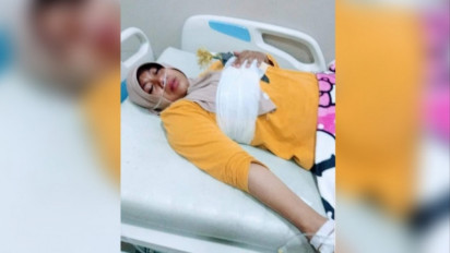 Update Bidan Tertancap Busur di Payudara, Bidan Ratnawati Akhirnya Dirawat di Rumah, Dokter Ceritakan Kronologis