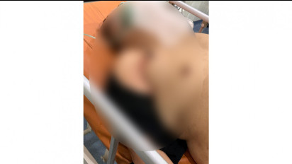 Selisih Paham Polisi Ditusuk Penjual Roti Bakar