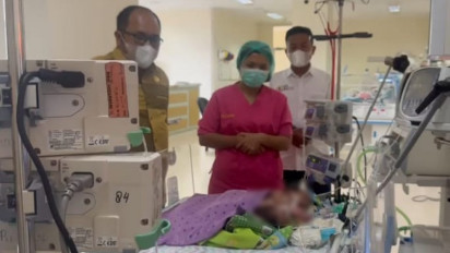 Bayi Kembar Siam Asal BatuBara di RSUP Haji Adam Malik Butuh Donor ASI
