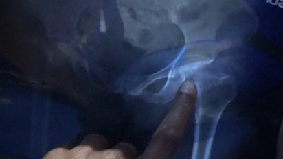 Polisi Selidiki Kasus Penganiayaan Nenek Penjual Kue Keliling di Gowa Oleh Oknum ASN