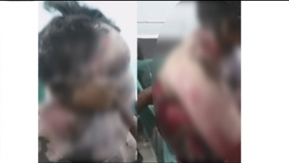 Lantaran Minta Uang Tidak Terpenuhi, Seorang Anak di Dairi Nekat Bakar Ibu Tiri Hingga Tewas