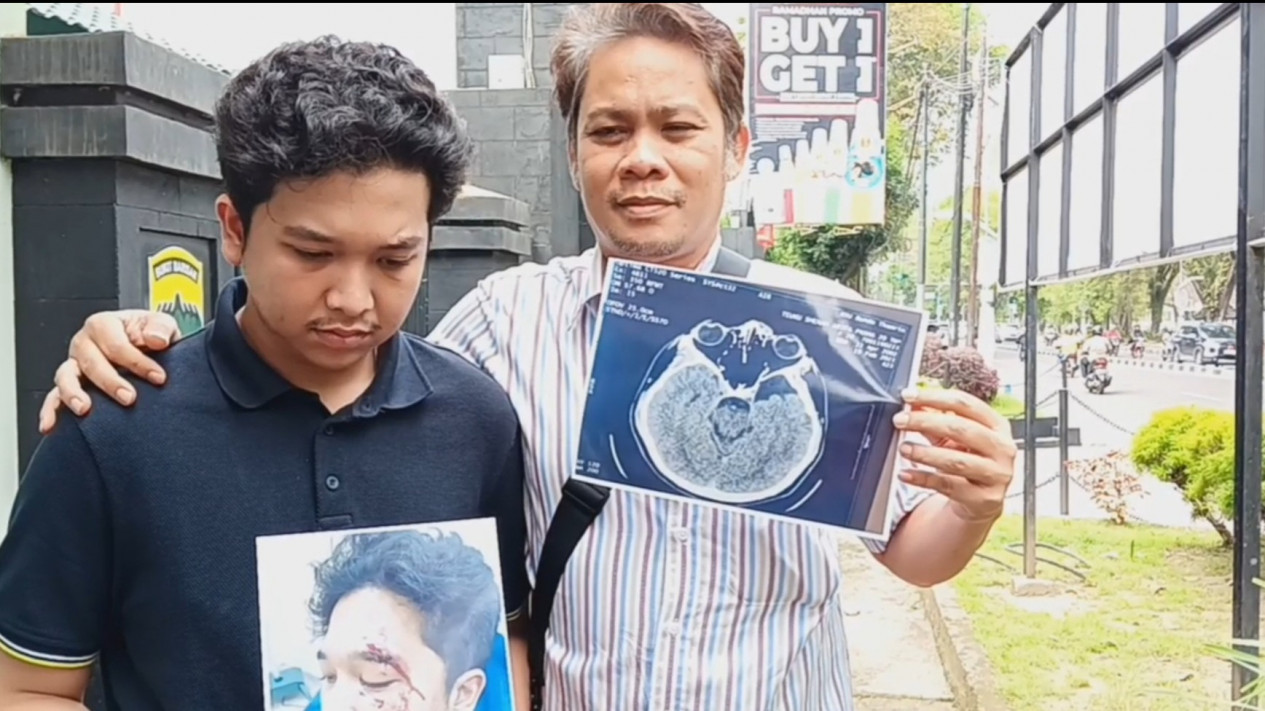 Alami Pergeseran Otak Kiri, Fisik Shehan Mengkhawatirkan Pasca Dianiaya Taruna Akmil, Begini Kondisinya
            - galeri foto