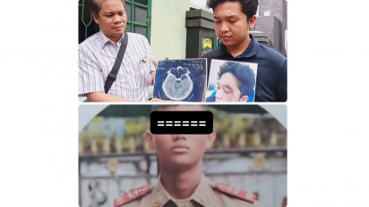 Mirip Kasus Mario Dandy, Begini Cara Taruna Akmil Aniaya Mahasiswa Kedokteran di Medan