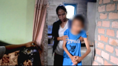 Seorang Remaja 18 Tahun di Prabumulih Menderita Gizi Buruk dan Stunting