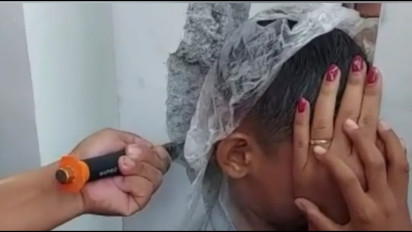 Kepala Bocah 8 Tahun Terjepit Pilar Teras Rumah di Madiun, Ini Cara Petugas Damkar Evakuasi