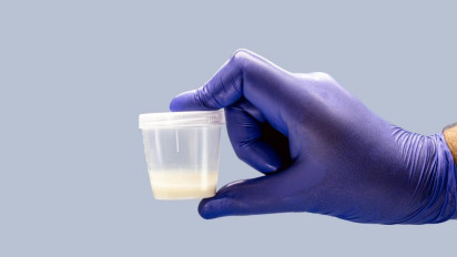 Rajin Donor Sperma, Pria Belanda Ini Punya 500 Anak dan Digugat ke Pengadilan