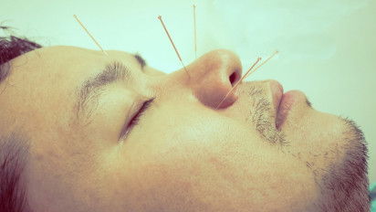 Bikin Geger, Dokter Stephanie Ungkap Fenomena Susuk Dalam Dunia Medis, Ternyata Pernah Ada Penemuan Susuk di Bagian ini