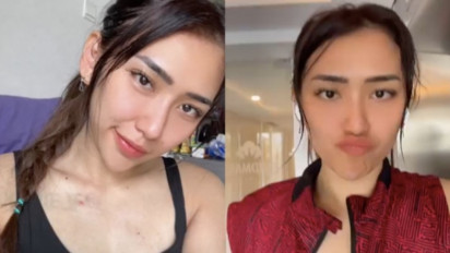 Yolla Yuliana Uggah Foto Gemas di Instagram, Lalu Tulis: Canda Jangan ‘Baper’