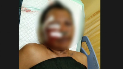 Bikin Sedih, Sudah 5 Bulan Pelaku Penganiayaan di Panceng Gresik Belum Tertangkap