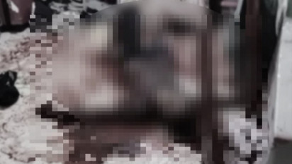 Cemburu Buta Mantan Istri Nikah Lagi, Pria di Medan Bacok Suami Sah Mantan Istri