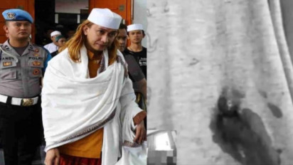 Kondisi Terkini Habib Bahar bin Smith usai Ditembak Orang Tak Dikenal, Polisi: Ada Luka di …