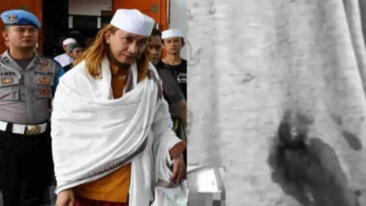 Update! Kasus Habib Bahar Bin Smith Ditembak, Polisi sebut Tak Temukan Proyektil Peluru di TKP