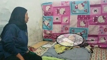 Menderita Hidrosefalus Bayi 19 Bulan di Bandung Butuh Uluran Tangan, Hanya Tinggal Dengan Sang Kakek dan Nenek