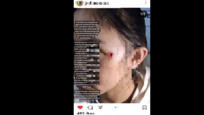 Viral! Diduga Anak Pejabat Kemendikbud RI Aniaya Teman Sekelasnya di Tasikmalaya