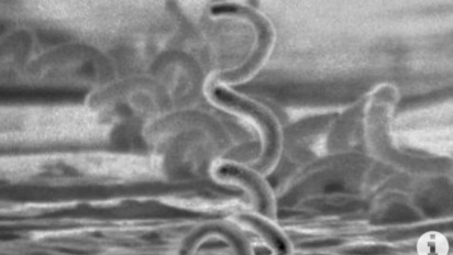 Dinkes Tanggamus Temukan 3 Kasus Penyakit Sifilis pada Awal 2023