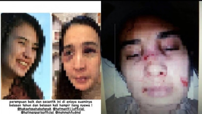 Viral Laporkan KDRT Istri Malah Jadi Tersangka, Sang Ayah: Balqis Dipukuli Disaksikan Asisten Rumah Tangga