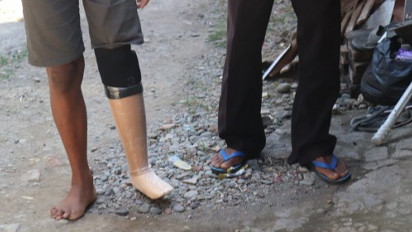 Manfaat Bantuan Kaki Palsu Bakrie Amanah kepada Penyandang Disabilitas di Indramayu Digunakan untuk Berjualan Kue Keliling