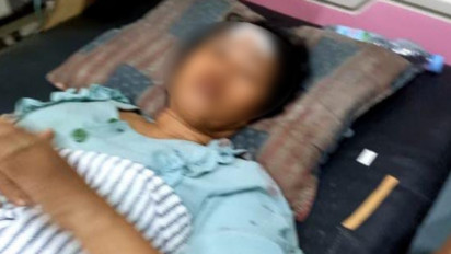 Ini Kesaksian Korban, Pasca Truk di Probolinggo Terguling