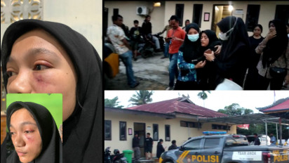 Babak Belur Dianiaya Senior, Keluarga Mahasiswi Teknik UHO Kendari Melapor ke Polisi