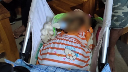 Balita asal Madiun Menderita Atresia Bilier, Penyakit Langka Sejak Lahir