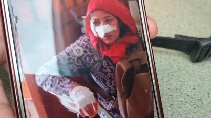 Tabung Gas Penjual Sosis Meledak, 3 Murid TK dan 2 Guru Terluka