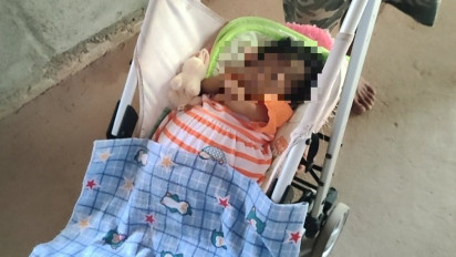 Kenali Atresia Bilier, Penyakit Langka yang Bisa Sebabkan Kematian pada Bayi