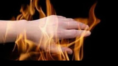 Anak Jalanan Nekat Bakar Diri di Jakarta Timur, Ini Keterangan Polisi